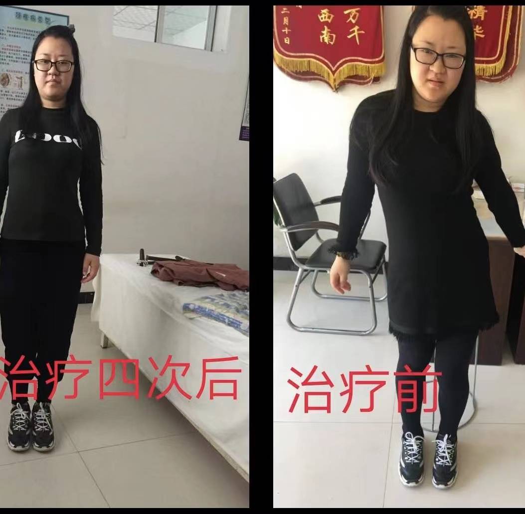 鉅鹿內病外治新療法學校：中醫針灸按摩/足療按摩針灸/針灸理療技術培訓先驅者